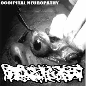 Hydrocephalus - Occipital Neuropathy flac